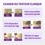 SOMEBYMI RETINOL INTENSE CREME YEUX TRIPLE ACTION 30 ML – Image 3