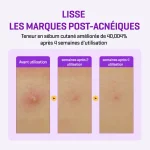 RETINOL INTENSE REACTIVATING SERUM 30ml – Image 4